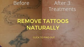 How To Remove Tattoos Naturally [upl. by Efram]