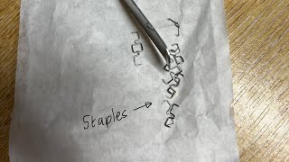 Staples out let the food and feeding challenge begin [upl. by Gneh]