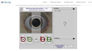 Astigmatismo Miope  Tutorial Retinoscopia [upl. by Asilef]