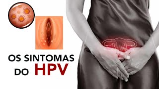 Os sintomas do HPV [upl. by Malchy843]