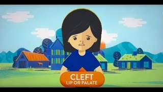 Understanding Cleft Conditions  A Cleft FAQ [upl. by Carmina138]