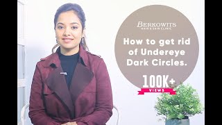 How to Get Rid of quotUnder Eyes Dark Circlesquot [upl. by Hagi]