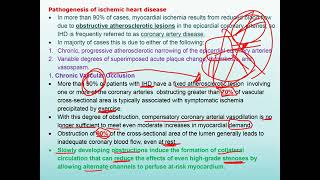 ischaemic heart disease [upl. by Inavoj688]