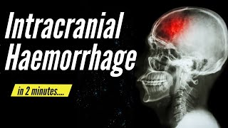 Intracranial Haemorrhage in 2 minutes [upl. by Corbett351]