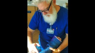 How to Apply amp Bivalve a Fiberglass Short Leg Cast [upl. by Atteloiv701]