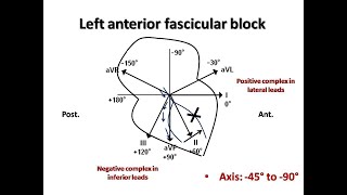 ECG course Fascicular Blocks Dr Sherif Altoukhy [upl. by Kentigerma]