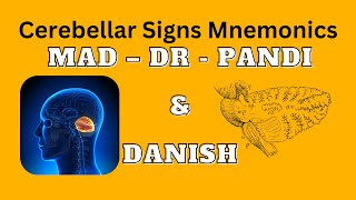 Cerebellar Signs Mnemonics  MAD DR PANDI amp DANISH [upl. by Aikimat891]