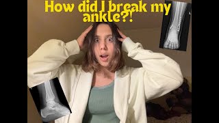 My broken ankle journey ORIF ankle surgery recovery [upl. by Nitsreik86]