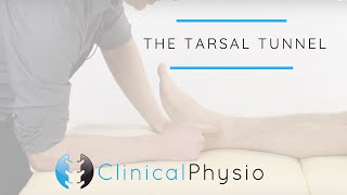 Tarsal Tunnel Test  Clinical Physio [upl. by Gottlieb666]