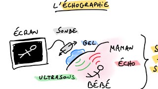 Léchographie 🩻 [upl. by Asile]