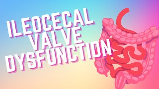 ILEOCECAL ICV VALVE DYSFUNCTION [upl. by Carlie512]