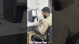 CBC Blood Test [upl. by Anderea]