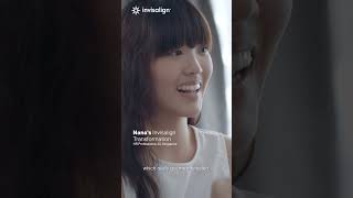 Nanas Invisalign Transformation  Invisalign India invisalignsmile [upl. by Aleac]