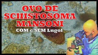 Ovo de Schistosoma Mansoni em Lâmina  Com lugol e Sem Lugol  Parasitologia  Bioquímica de Forma [upl. by Ybhsa]