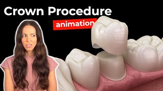 Dental Crown Procedure at the Dentist [upl. by Annala]