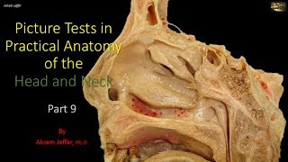 Picture tests in head and neck anatomy 9 [upl. by Epstein426]