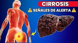 11 Señales Tempranas de Cirrosis Hepática que No Debes Ignorar [upl. by Wilburt]