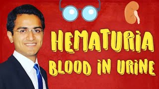 Hematuria Causes amp Diagnostic Workup of Blood in Urine [upl. by Resiak]