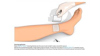 How to use ADAPTIC TOUCH [upl. by Bicknell377]