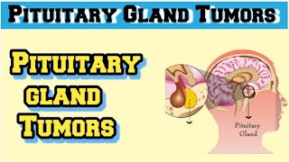 pituitary adenoma pathology [upl. by Daye592]