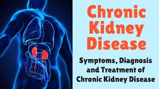 Chronic Kidney Disease Symptoms Diagnosis and Treatment of Chronic Kidney Disease [upl. by Llenoj31]