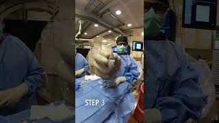 Live Kidney AML Angiomyolipoma Embolization Treatment Doctor [upl. by Krystin]