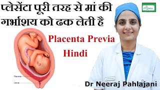 Placenta Previa होने के लक्षण इलाज और Low Lying Placenta से कैसे बचे [upl. by Llener681]