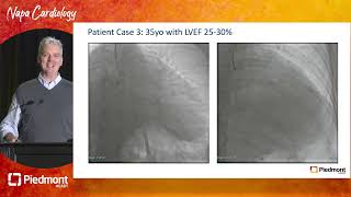 Appraisal of Successes and Shortfalls in CTO Revascularization [upl. by Animehliw]