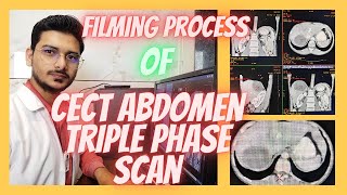 CT SCAN Abdomen Triple phase Filming process Triphasic abdominal Filming radiologytechnologist [upl. by Baudelaire]