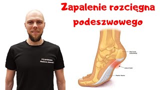 ZAPALENIE ROZCIĘGNA PODESZWOWEGO  kogo dotyczy❓ [upl. by Limemann]