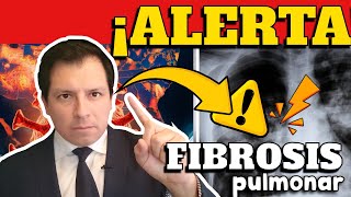 ALERTA ⚠️ CIENTÍFICOS REVELAN QUE INCIDENCIA DE FIBROSIS PULMONAR INCREMENTARÍA POR COVID19 [upl. by Martine767]