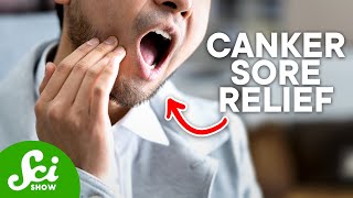 How to Get Rid of Canker Sores According to Science [upl. by Merta182]