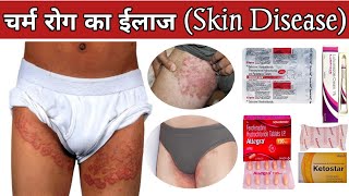 चर्म रोग का ईलाज Skin Disease Treatment  Bacterial amp Fungal infection IndianMedicalLecture [upl. by Eniamrej]