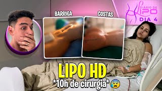 4 DIÁRIO DE LIPO CHEGOU O DIA DA CIRURGIA MOSTRANDO TUDO [upl. by Jacoba339]