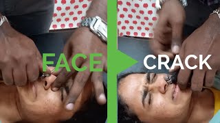 CRANIAL FACIAL RELEASE Technique by DrSuresh KumarCFR technique in India [upl. by Anha]