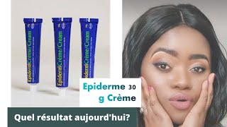 Mon avis sur épiderme 30g aujourdhui comment choisir sa crème de visage🙄🙄 [upl. by Atiluj]