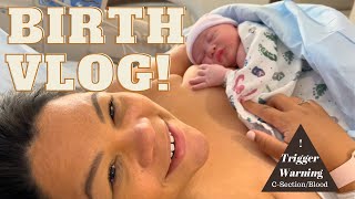 EMOTIONAL BIRTH VLOG  CSECTION VLOG 2022  GRAPHIC CONTENT WARNING  Labor and delivery [upl. by Baker]