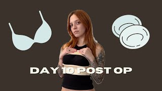 Day 10 Post Op of Breast Augmentation [upl. by Adiehsar]