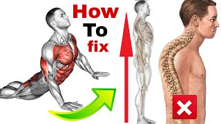 How To Fix An Arched Back💢Back arch exercises [upl. by Einahpit]