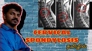 CERVICAL SPONDYLOSIS LECTURE IN TAMIL  கழுத்து வலி  SUNDERS MEDIPEDIA TAMIL [upl. by Lyda]