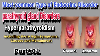 Hyperparathyroidism  Parathyroid gland Disorder By AbuBakar Med Plus [upl. by Aloel]