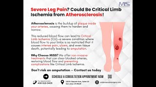 How Atherosclerosis Causes Critical Limb Ischemia [upl. by Itnaihc]