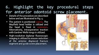 103 Type 2 Odontoid Fracture [upl. by Plerre]