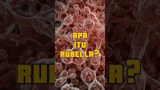 Apa itu Penyakit Menular Rubella rubella infeksirubella shorts [upl. by Neelyar]