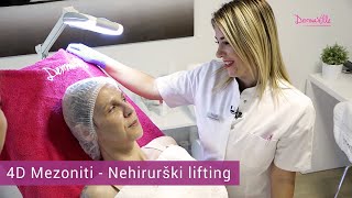 4D mezoniti  Nehirurški lifting donje trećine lica  Ljupka Trenutak iz sna 2  DermaVille [upl. by Mason369]