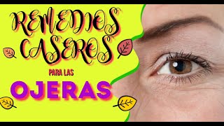 8 Remedios Caseros Para Las OJERAS [upl. by Airoled313]