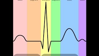 Non ST Elevation Myocardial Infarction NSTEMI in an Old Patient [upl. by Faustina322]