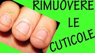 COME RIMUOVERE LE CUTICOLE Sos unghie 9 [upl. by Ahsial]