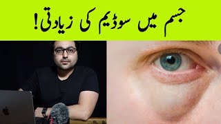 Dr ZeeHow To Get Rid of Puffy Eye bags पानी या वसा [upl. by Loeb]