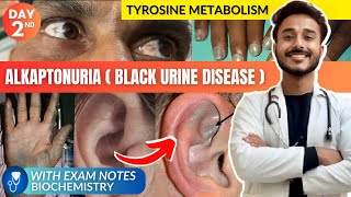 tyrosine metabolism biochemistry  alkaptonuria biochemistry  black urine disease biochemistry [upl. by Zannini298]